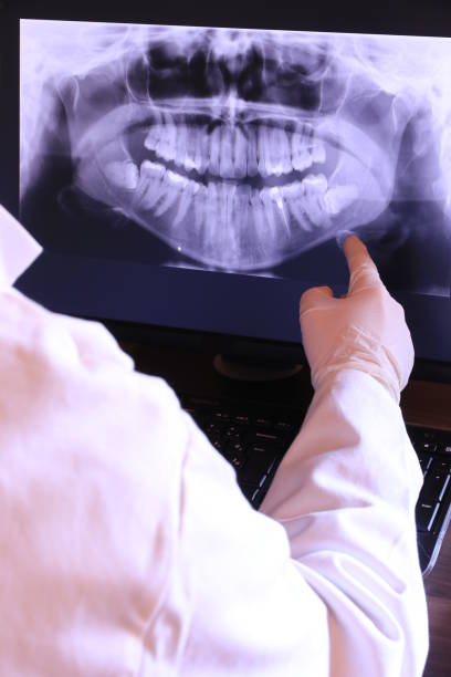 Best Emergency Treatment for Toothache in East Helena, MT